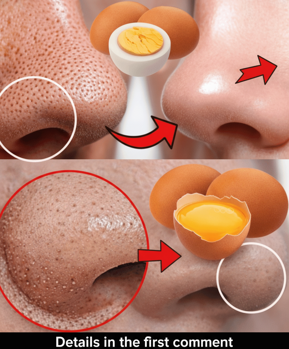 Unlock Clearer Skin: Your Guide to a DIY Egg White Face Mask at Home