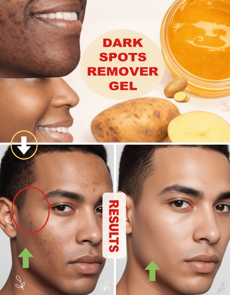 Unlocking Your Natural Glow: Harnessing Potatoes and Ginger to Combat Dark Spots for Luminous, Even-Toned Skin
