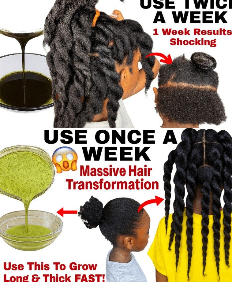 Don't Rinse It Out! Superior to Clove Water: Unlock Rapid Hair Growth with Rosemary and Aloe Vera