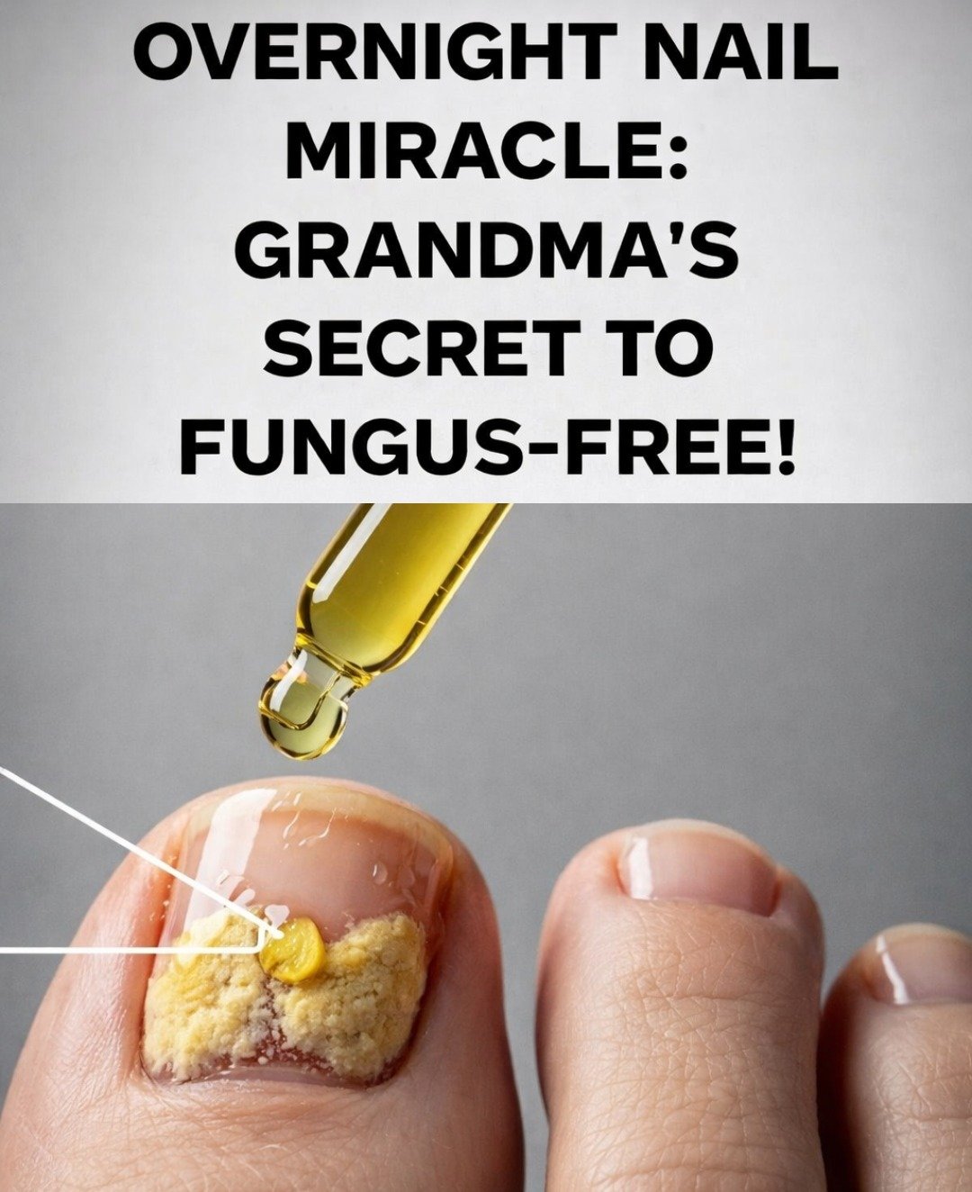 A Simple “Nail Spice” Ritual for Naturally Addressing Toenail Fungus