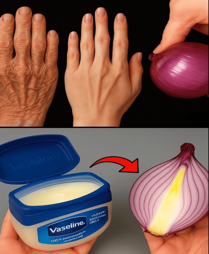 Harnessing Nature's Best: 5 DIY Onion and Vaseline Remedies for Younger-Looking Hands