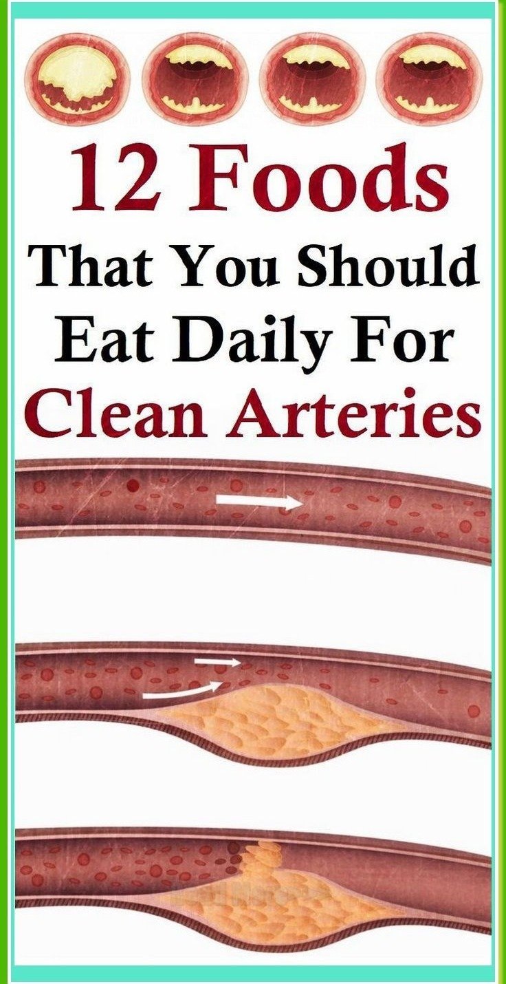 Boost Your Heart Health: 12 Daily Foods for Clearer Arteries