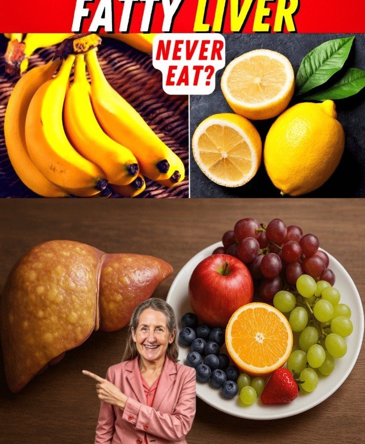 Navigating Fatty Liver: 5 Foods to Avoid and 10 Fruits to Embrace for Hepatic Steatosis