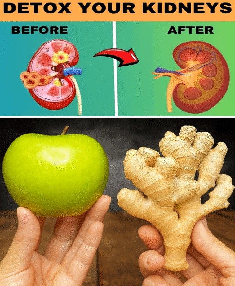 10 Natural Ways Apples and Ginger Can Detoxify Your Kidneys