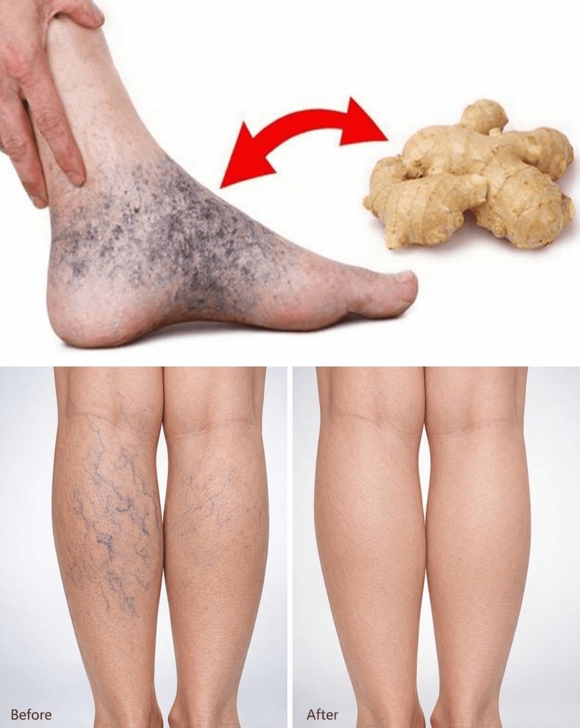 The #1 Kitchen Secret That Could *Erase* Your Varicose Veins & Leg Pain (Before It's Too Late!)