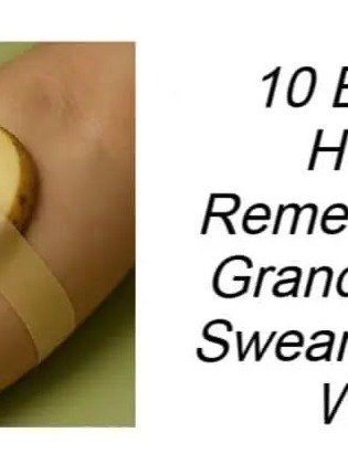 Grandma's Secret Stash: 10 Bizarre Home Remedies That Actually WORK (You Won't Believe #6!)