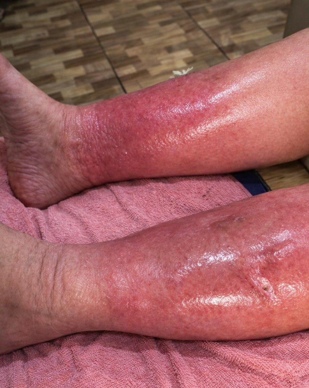 The Red Alert: Why That Innocent-Looking Skin Patch Could Be a HIDDEN Danger You Can't Afford to Ignore!