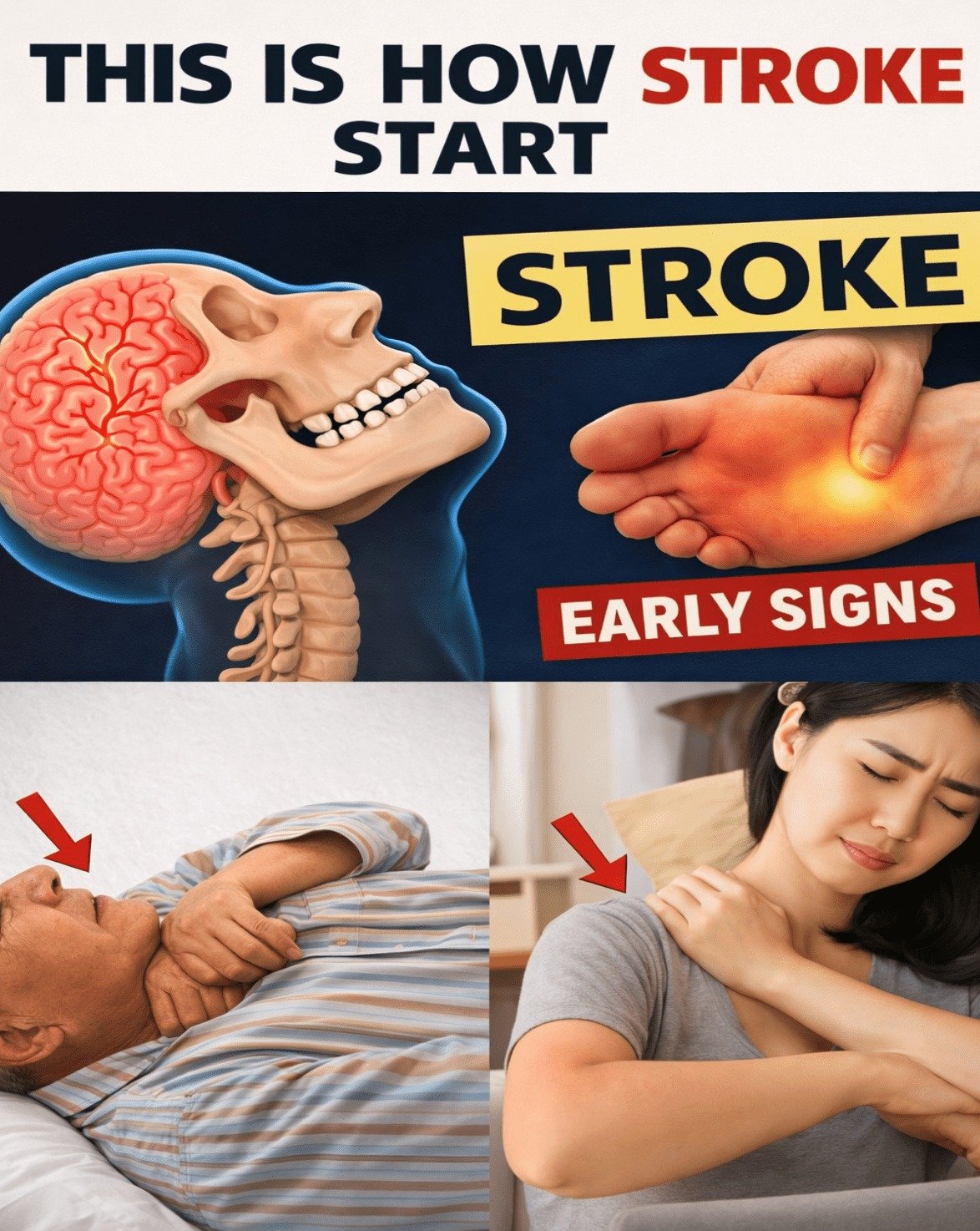 URGENT: 8 Silent Stroke Signs Your Body Whispers WEEKS Before (Plus 9 Life-Saving Prevention Hacks You Need to Know NOW!)