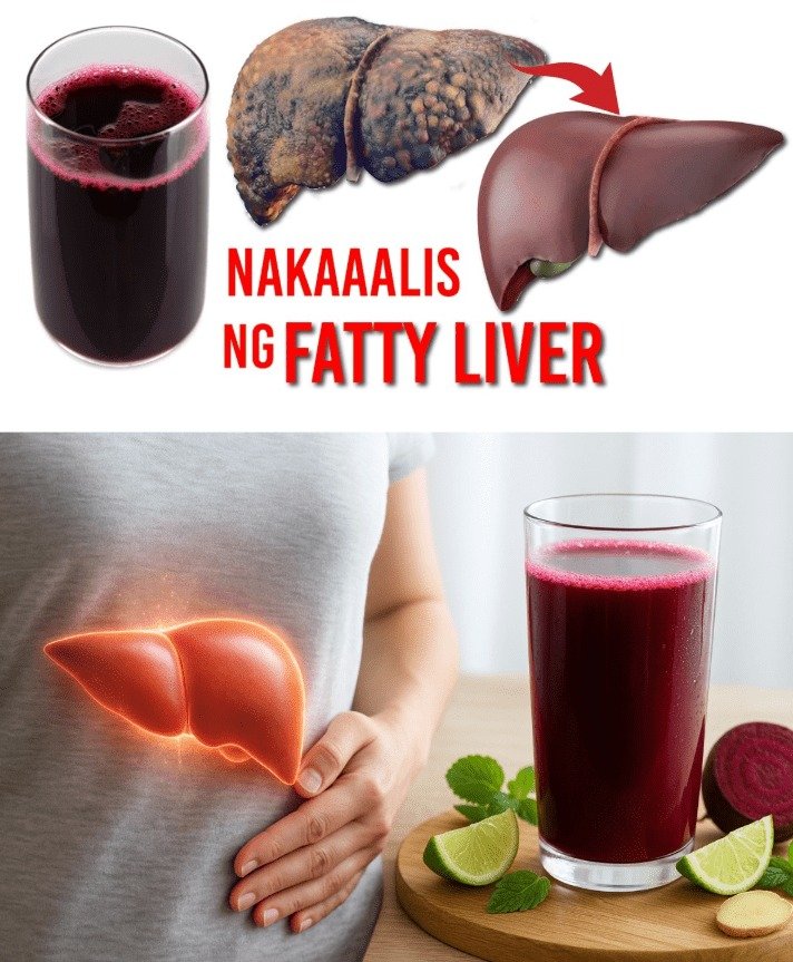 The Daily Brew: Can One Cup a Day Combat Fatty Liver Disease?