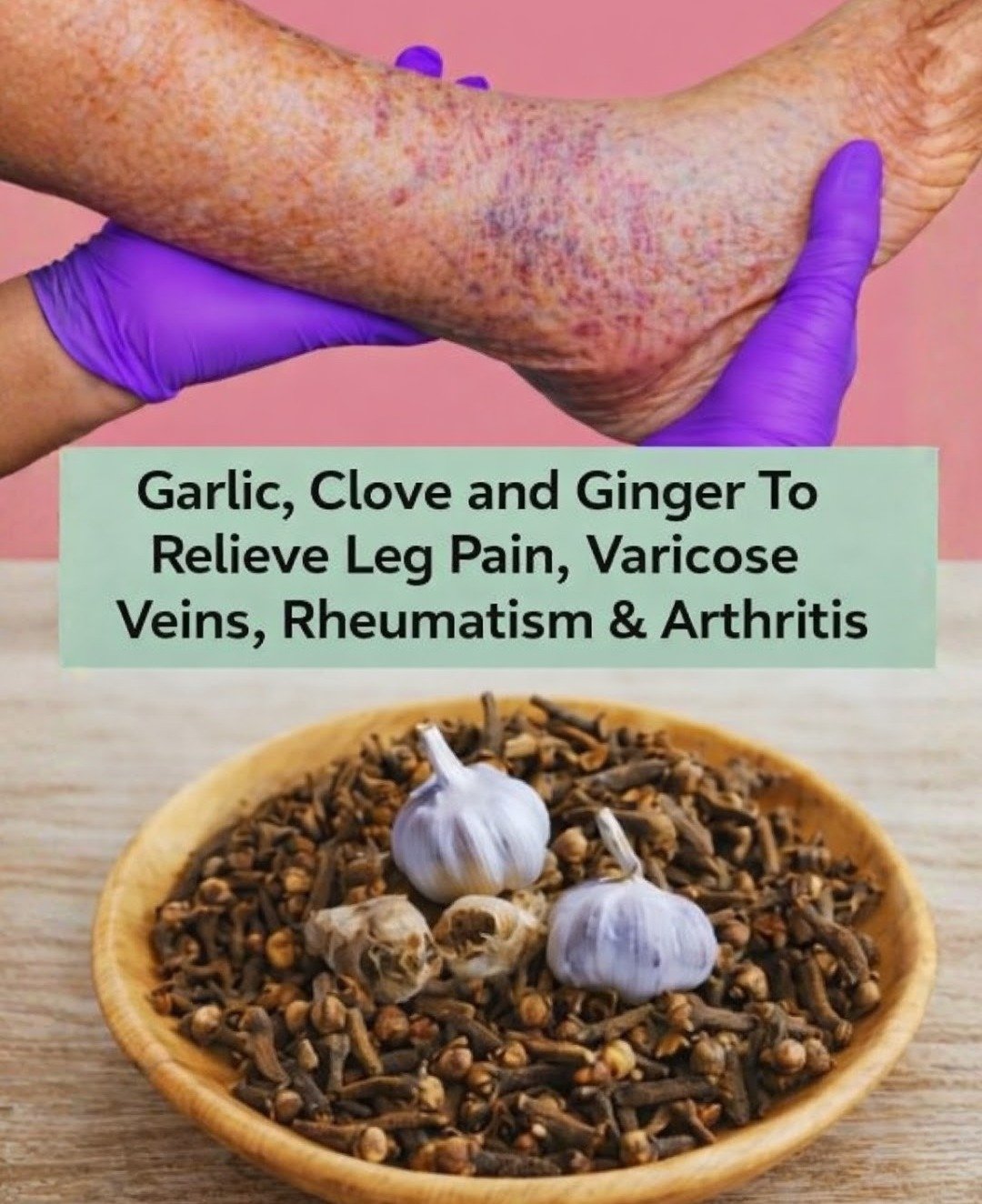 Natural Relief for Leg Pain, Rheumatism, and Arthritis: Harnessing Garlic, Cloves, and Ginger