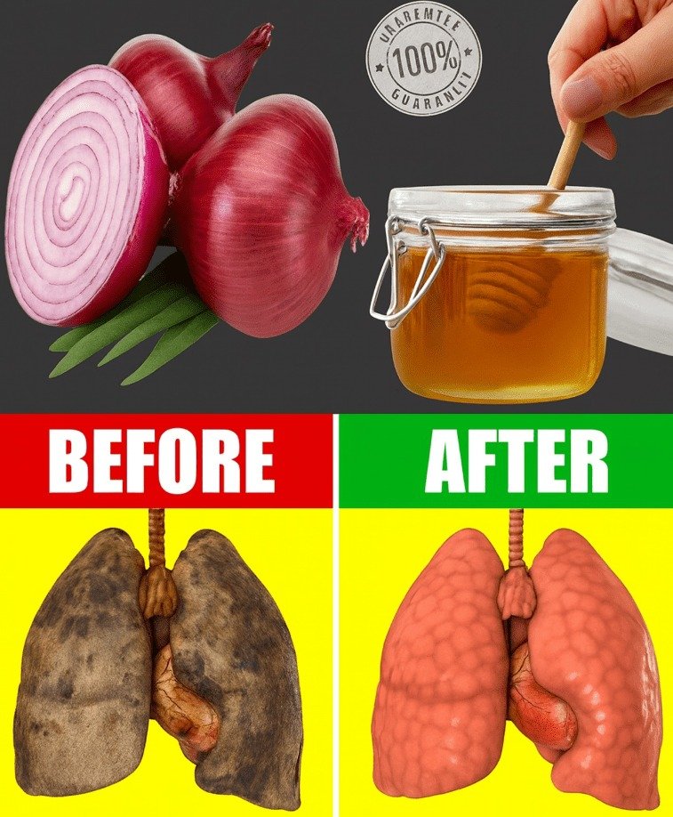 Uncover the Ancient Secret: How Onion and Honey Can Soothe Your Lungs and Calm Your Cough