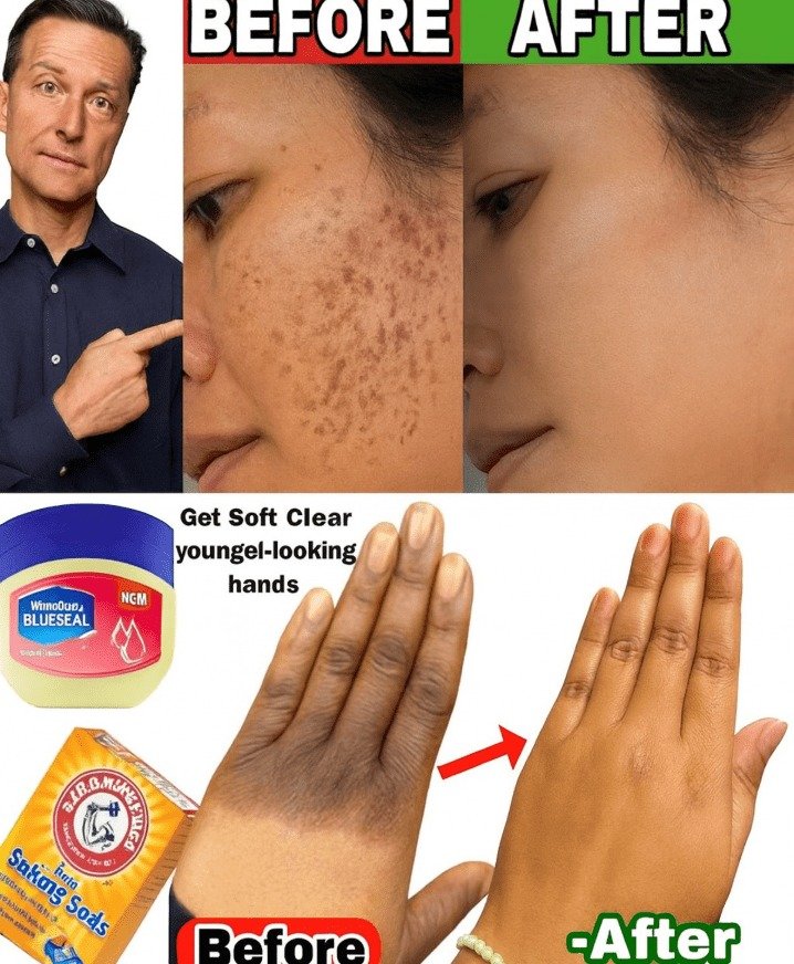 Unlock Clearer, Younger-Looking Hands with This Vaseline & Baking Soda Remedy (Before & After Guide)