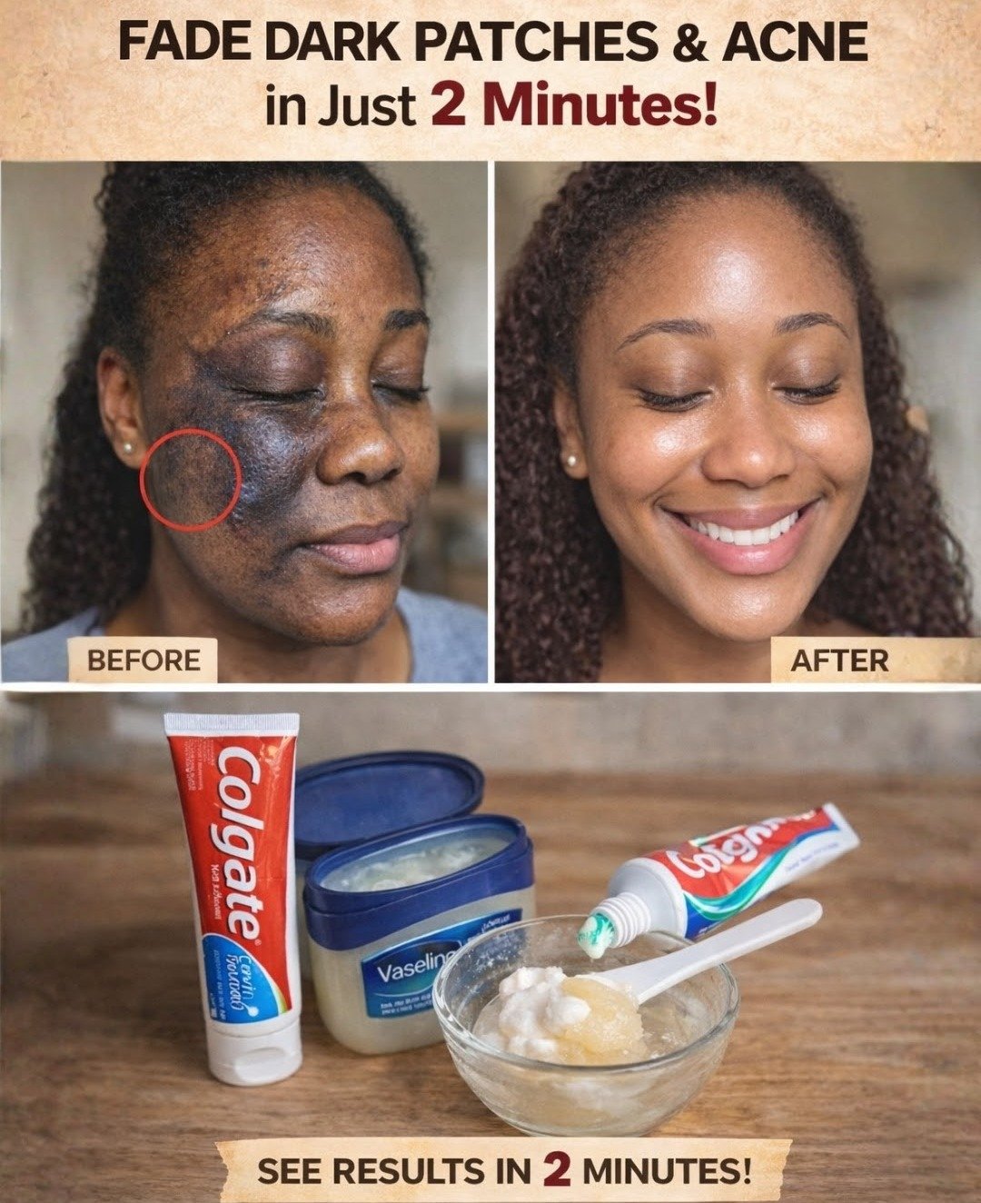 Unmasking the Truth: What Really Happens When You Apply Colgate and Vaseline to Your Face