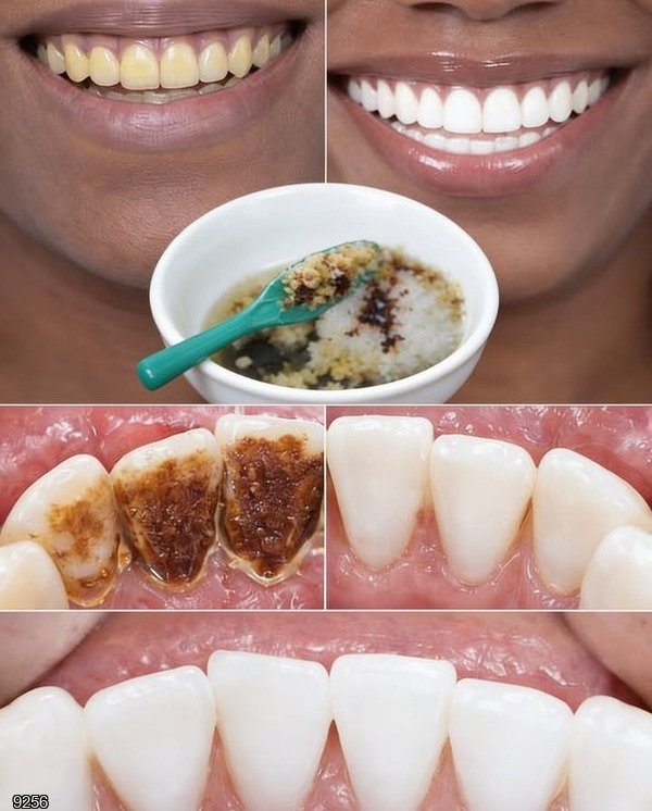 Unmasking the 2-Minute Promise: The Truth About Natural Teeth Stain Removal
