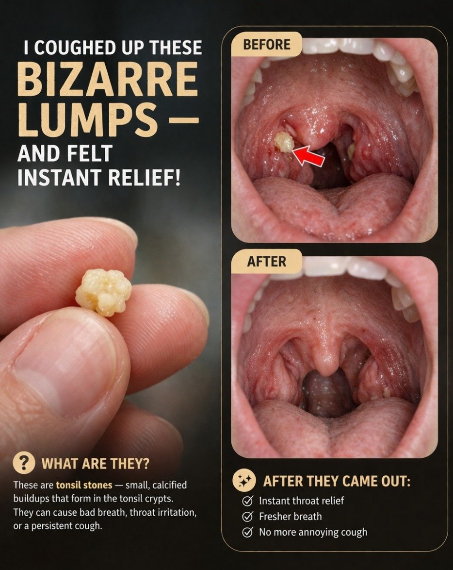 Ever Sneezed Out a Weird Little Lump? The Surprising Truth About What's Hiding In Your Throat!