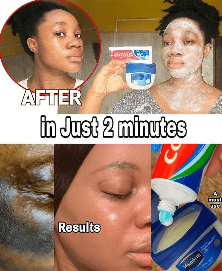 The Truth About Using Toothpaste and Vaseline on Your Face: What Really Happens?