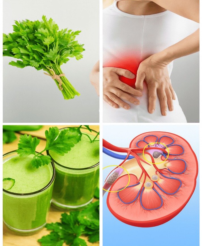 Unlocking Kidney Health: The Power of Parsley Juice for Cleansing and Stone Prevention