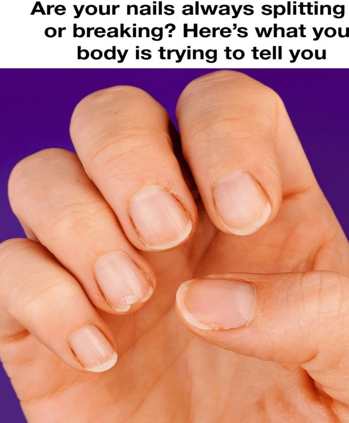 Decoding Brittle Nails: What Your Body Might Be Signaling