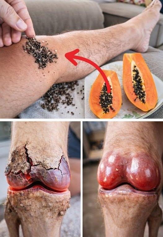 Unlocking Joint Comfort: Exploring Papaya Seeds as a Simple Home Habit for Knee, Back, and Spine Support