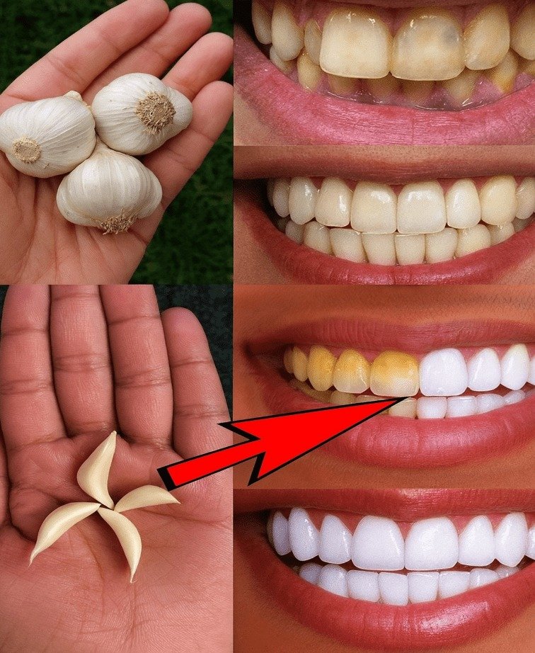 Unveiling Garlic's Surprising Role in Supporting a Brighter Smile