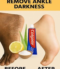 The Viral Colgate Foot Hack: Does Toothpaste Actually Work for Your Feet?