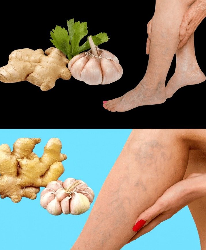 Supporting Leg Circulation and Varicose Vein Comfort with Ginger and Garlic