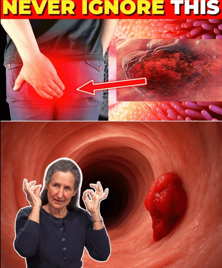 Crucial Colon Cancer Symptoms You Must Never Disregard