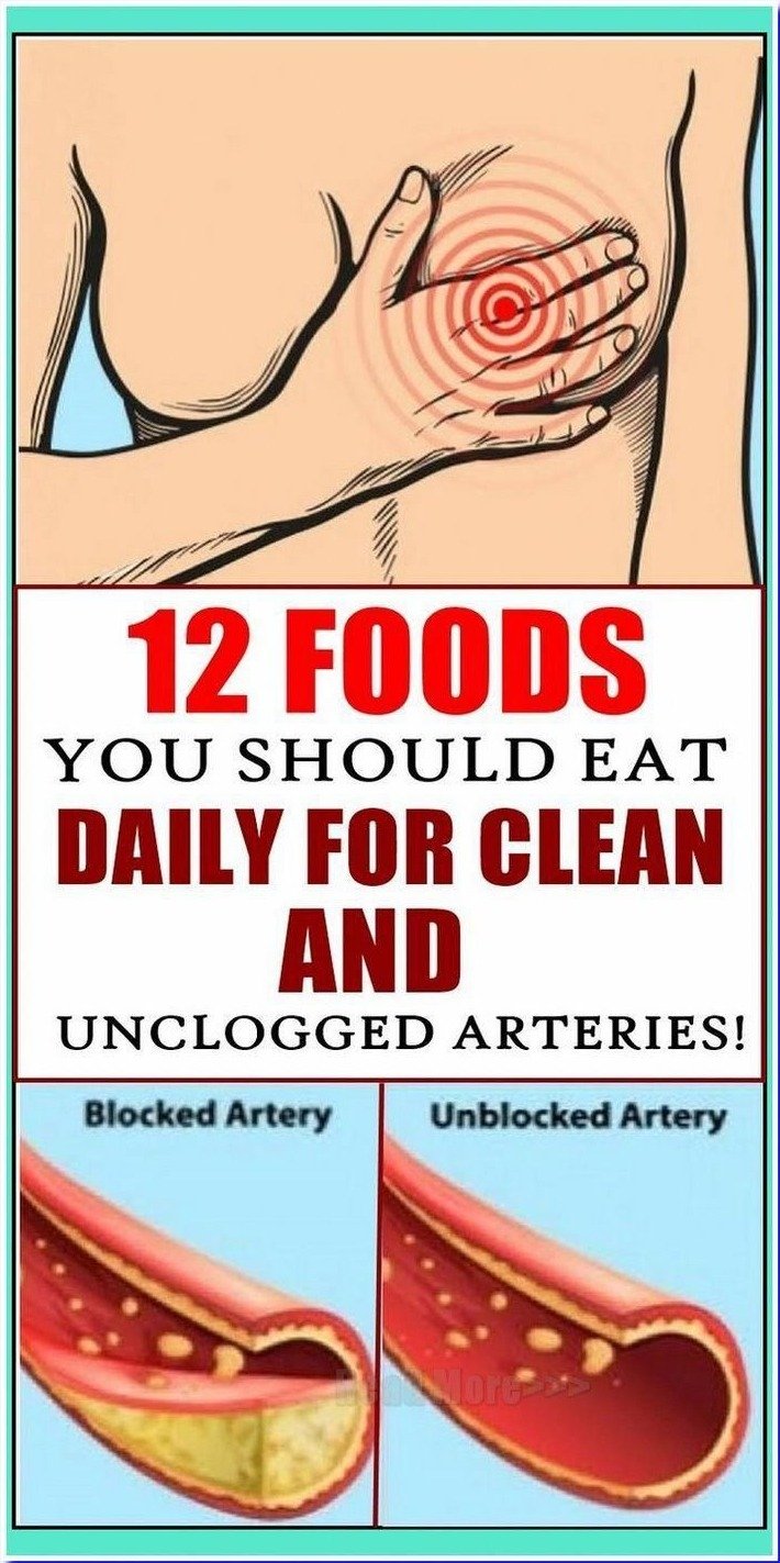 Shocking Truth: 12 Everyday Foods That Can Naturally Clean Your Arteries (Don't Miss #7!)