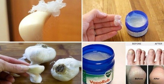 The Viral Vicks & Garlic Clove Hack: Is It a Genius Cure or a Dangerous Myth? What You *MUST* Know Before You Try It!