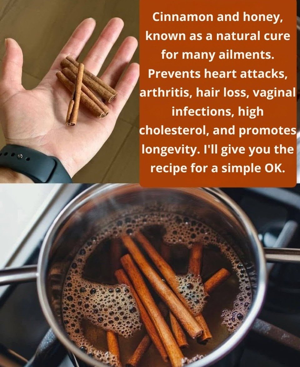 Cinnamon for Blood Sugar Management: Benefits, Usage, and Key Precautions