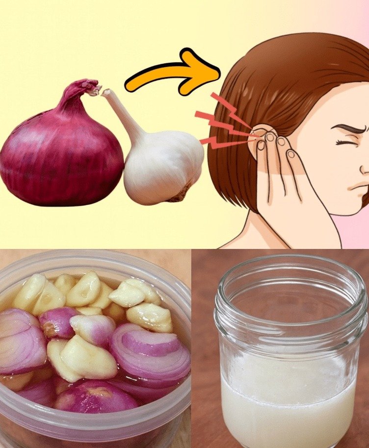 Unlocking Natural Hearing Support: The Power of Garlic and Onion