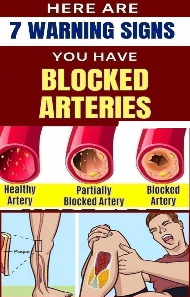 7 Vital Warning Signs That Could Indicate Blocked Arteries