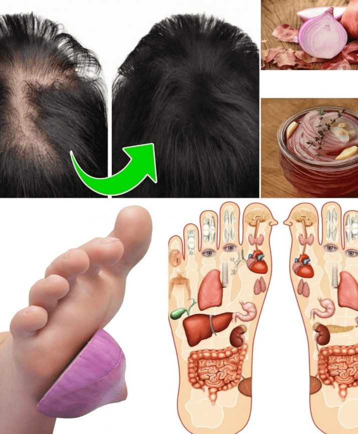 Harness the Power of Onions: 14 Clever Ways to Boost Your Health Naturally at Home