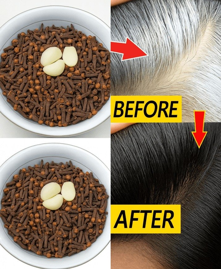 Unlocking the Potential of Cloves and Garlic for Gray Hair: 10 Key Insights