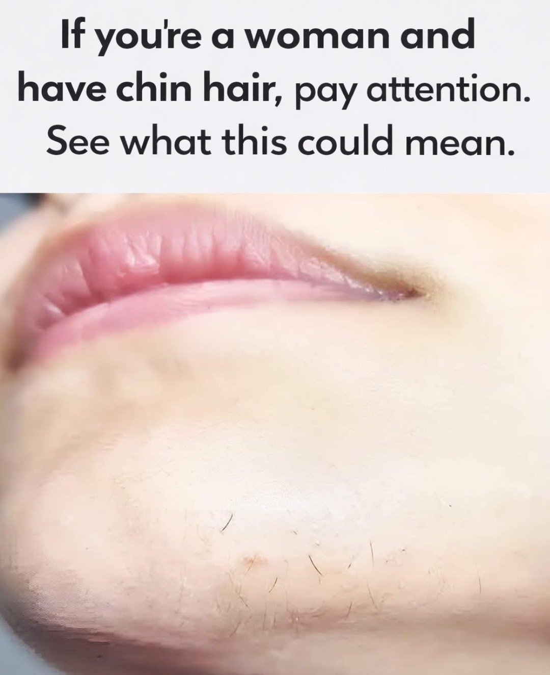 Understanding Chin Hair in Women: Health Implications and Causes