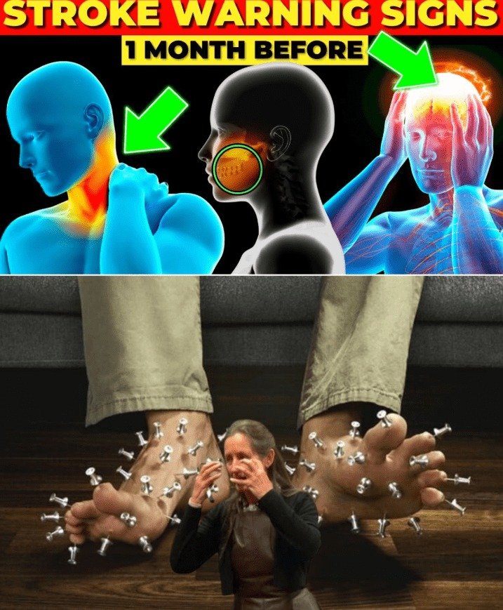 Early Warning Signs of Stroke: 7 Symptoms to Recognize a Month in Advance