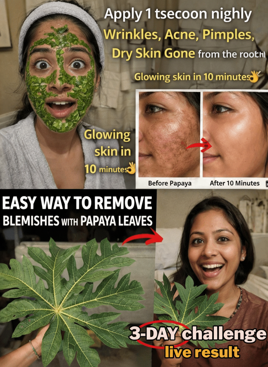 Papaya Leaf Power: Your Natural Secret to Fading Melasma and Uneven Skin Tone