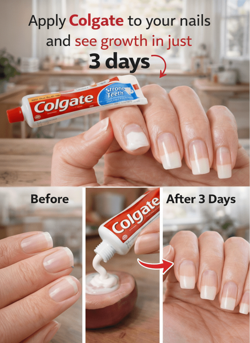 Unlock Stronger, Faster-Growing Nails: The Natural Power of Onion and Other Homemade Remedies