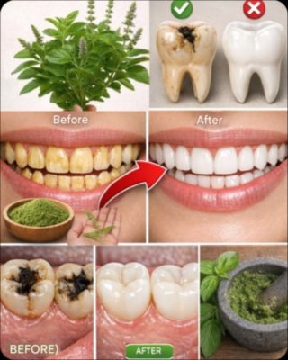Unlock Nature's Dentist: The Ancient Herb That Could REVOLUTIONIZE Your Oral Health!