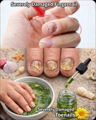 Unlock Flawless Nails & Glowing Skin: The Simple 10-Minute Herbal Secret You NEED to Try NOW!