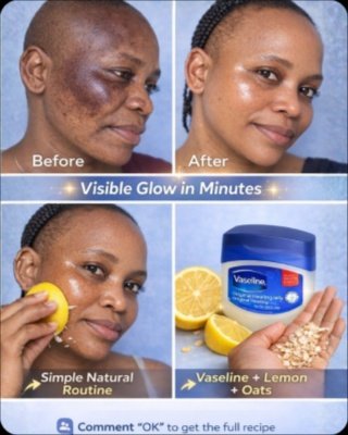 The #1 Kitchen Secret to Fading Stubborn Acne Marks: Why Everyone's Raving About Lemon Juice (And How YOU Can Get Results!)