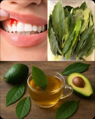 Unlock the Secret: This 7-Day Avocado Leaf Hack Will Transform Your Gums & End Bleeding!