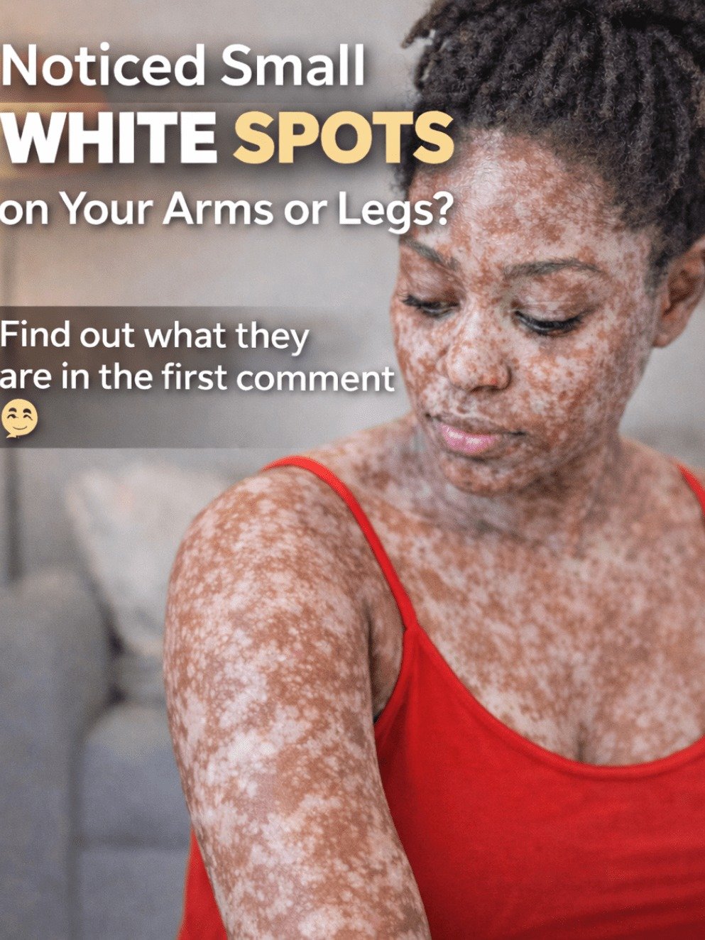 What Are Those White Spots? The Surprising Reason They Appear & 1 Daily Habit That Could Transform Your Skin!