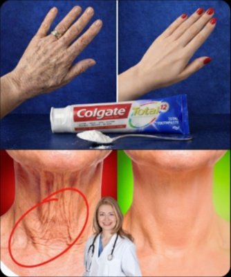 Viral Skin Hack: See How Colgate, Baking Soda, Honey & Turmeric Can TRANSFORM Your Complexion!