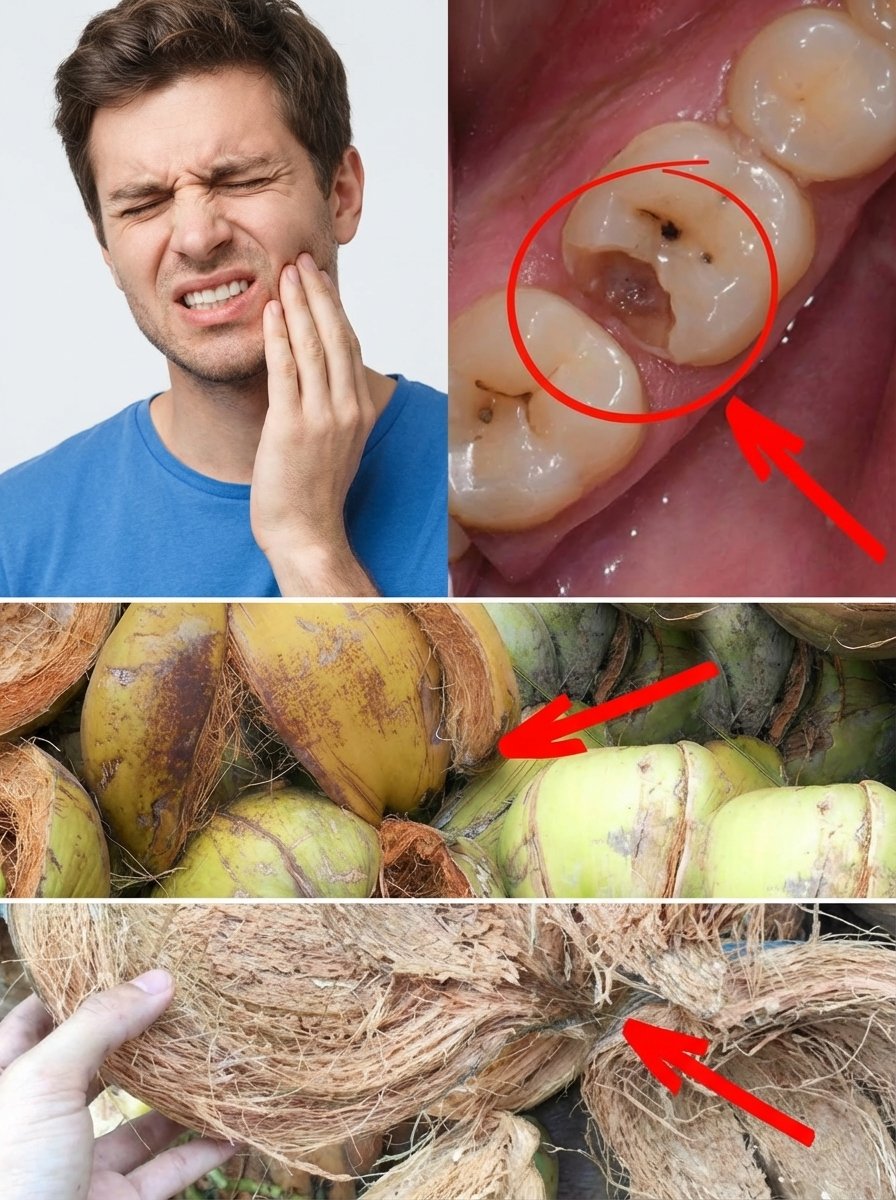 Unbelievable! This Discarded Coconut 'Waste' Could End Your Toothache Torment in Just 4 Days