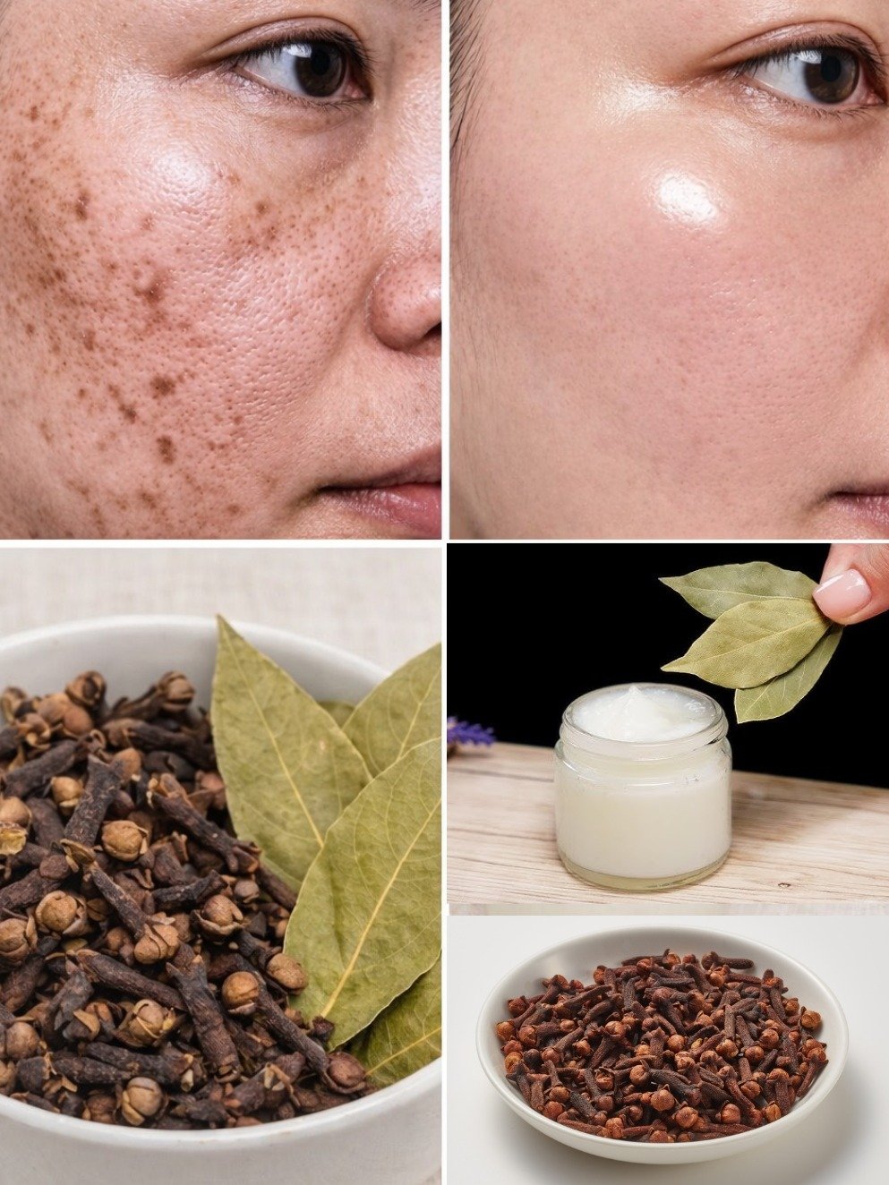 Erase Dark Spots FOREVER: The #1 Natural Secret to Achieve Flawless, Glowing Skin (You'll Wish You Knew Sooner!)