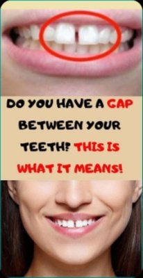 The SHOCKING Truth: Your 'Healthy' Oral Care Routine Is DESTROYING Your Smile & Body (And What To Do Now!)