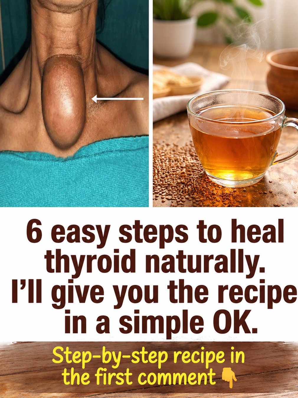 Unlock Your Energy: 6 Natural Thyroid Boosters You Can't Afford to Ignore!