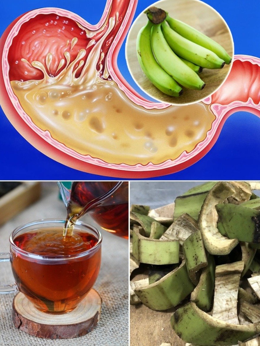 STOP Throwing Them Out! The Secret Power of Plantain Peels for Instant Stomach Relief You NEED to Know