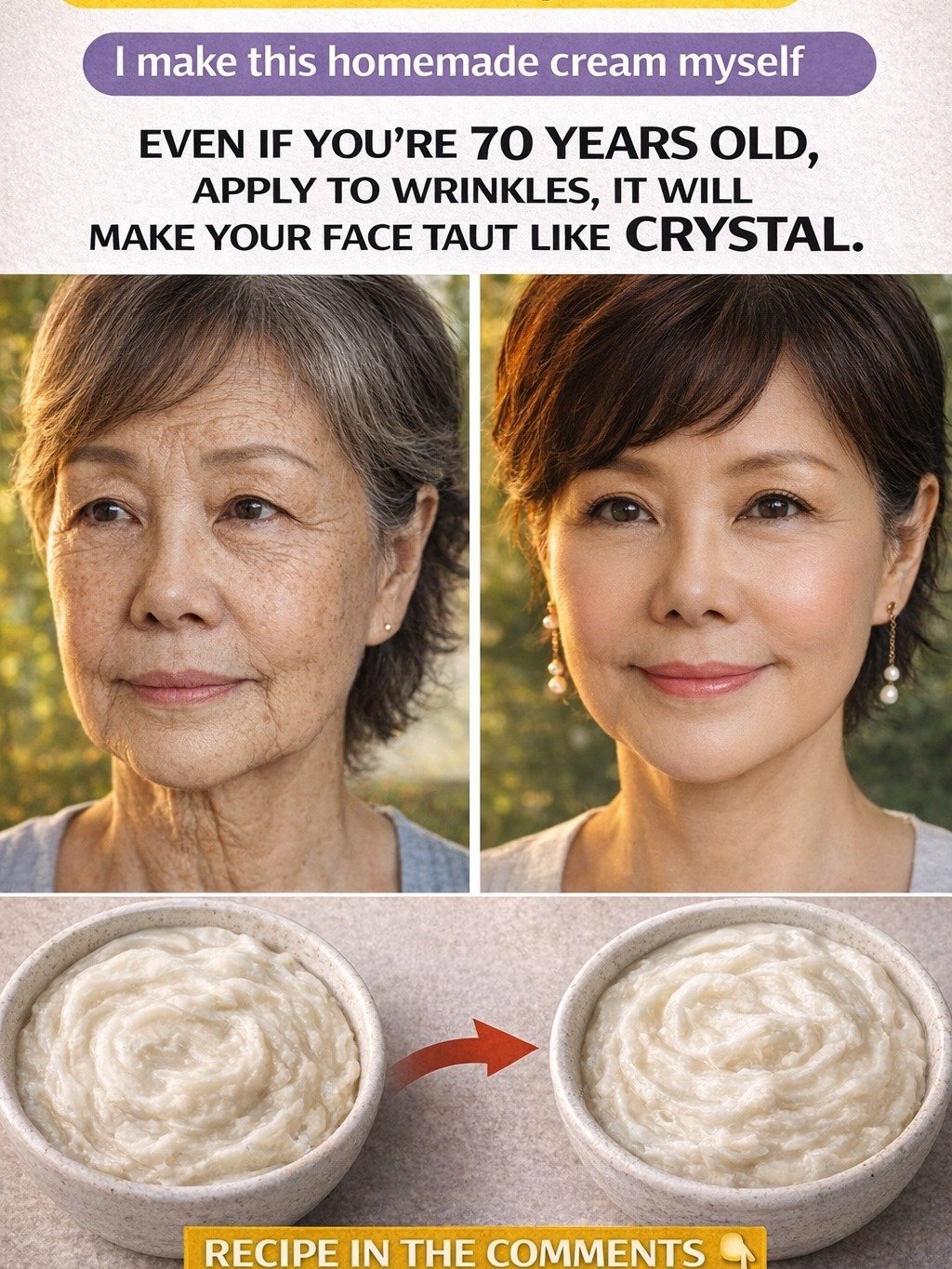 Unbelievable! This 3-Ingredient Homemade Cream Is Making Women Look 30 Years Younger (Baking Soda Secret Revealed!)